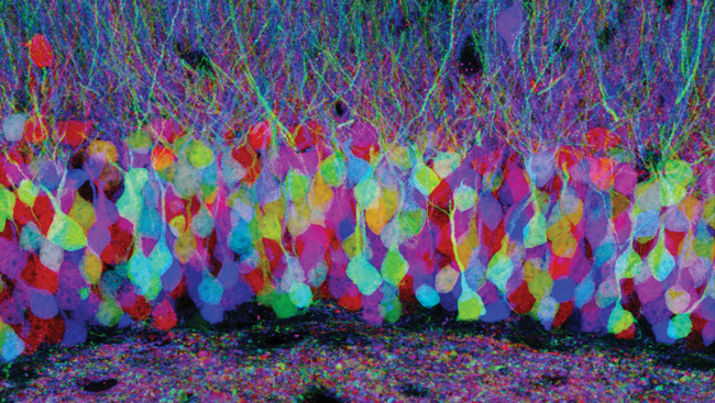 Dyed brain cells create a colorful 